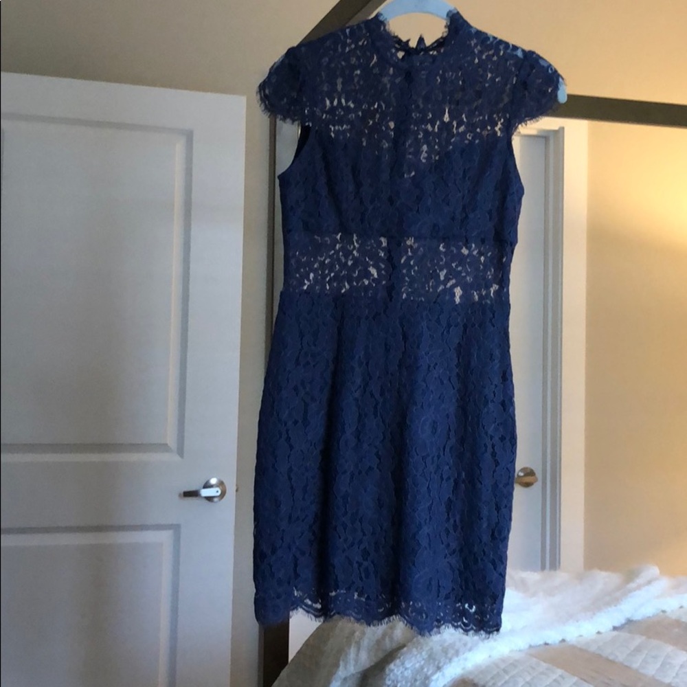 Dolce Vita Fitted Lace Dress